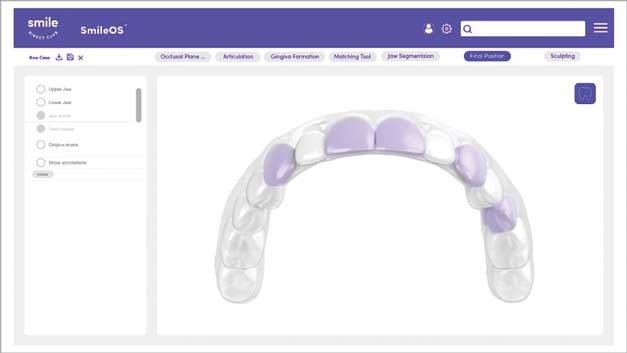 SmileOS Treatment Planning Software 